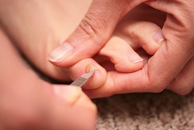 hogyan kell kezelni a körömgombát a kéznél körömlakk hatását a gomba